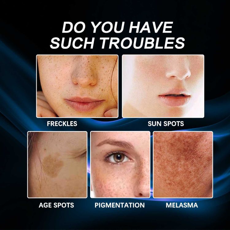Vitamin C Whitening Freckles Face Cream